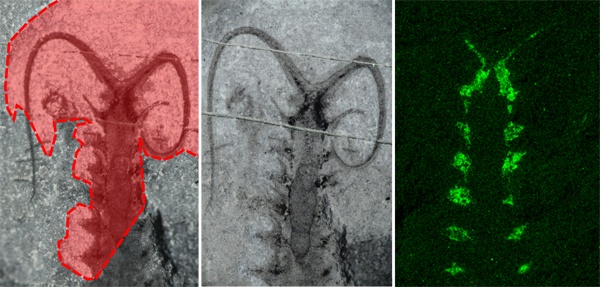 Two X-ray images of a kidney with a highlighted renal artery in red on the left, and a vertical green fluorescent image of kidney glomeruli on the right.