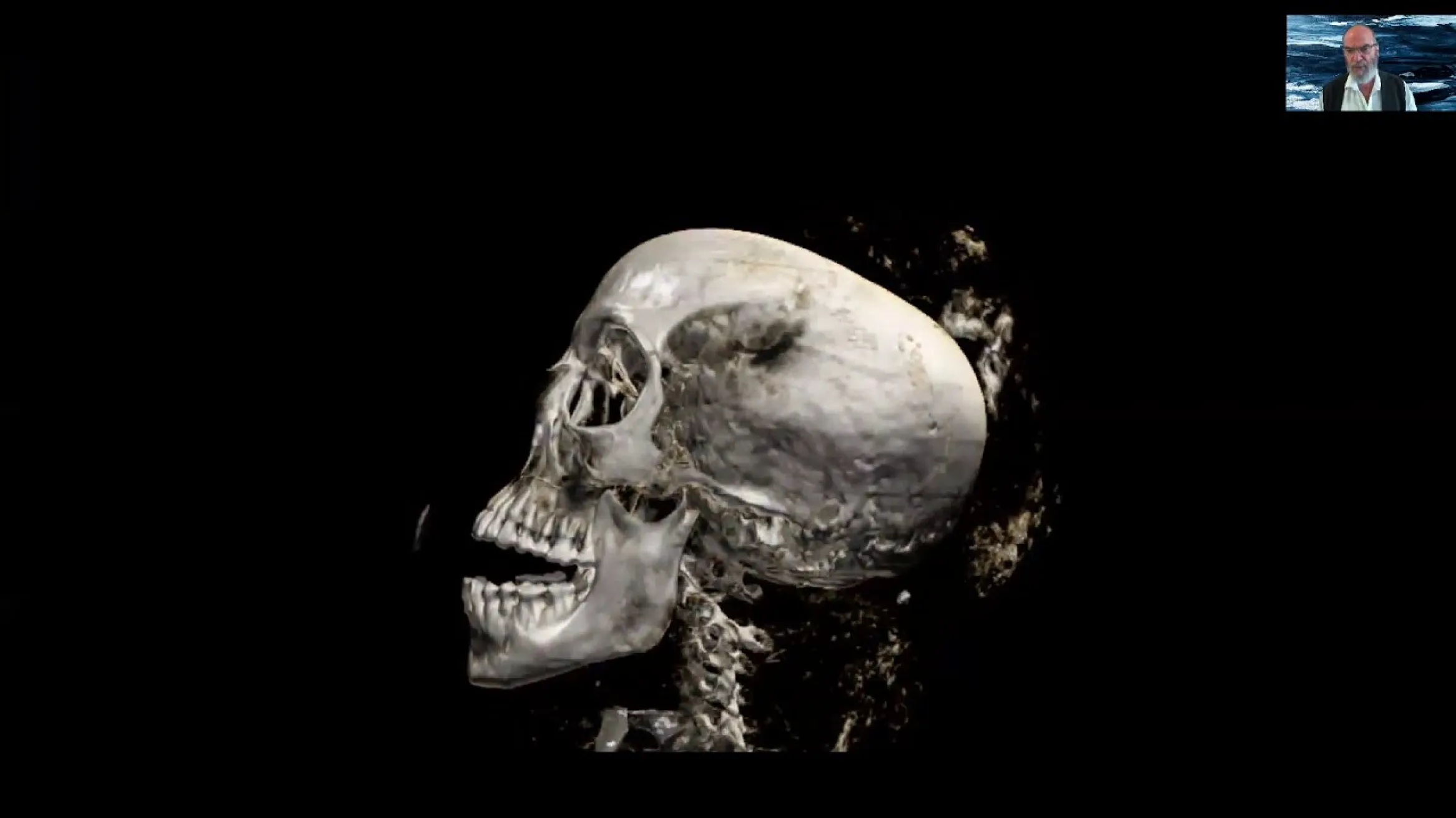 CT Video of Nefer-Mut
